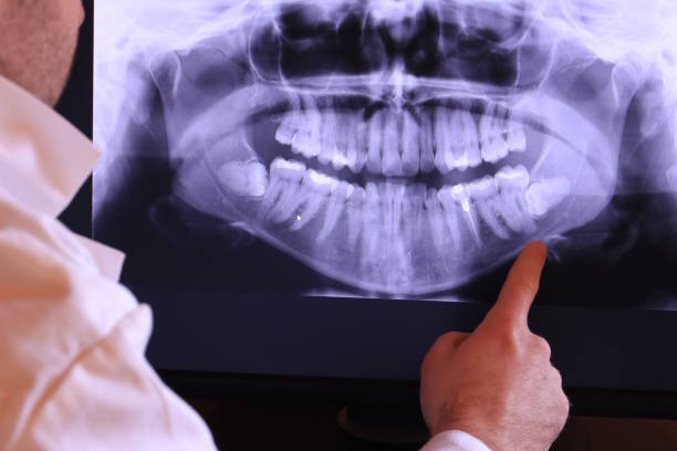 Best Emergency Dentist for Knocked-Out Tooth in Cape Girardeau, MO