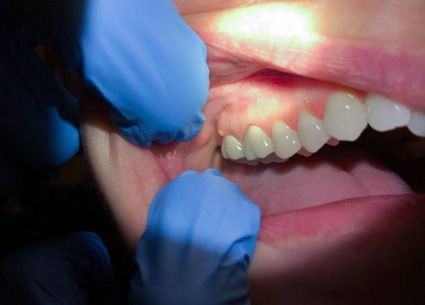 Best Mobile Emergency Dentist in Cape Girardeau, MO
